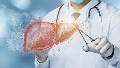 Liver Transplant